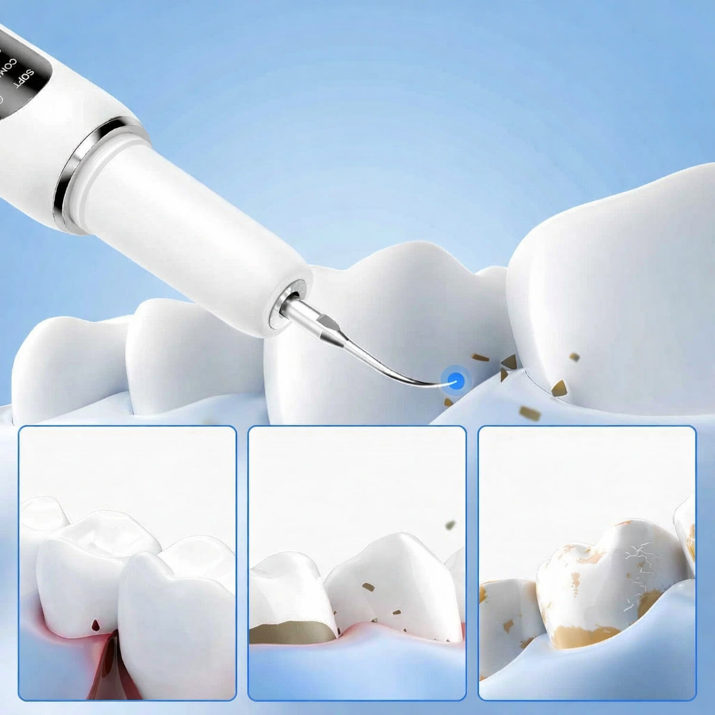 Smart Ultra-Sonic Teeth Cleaner