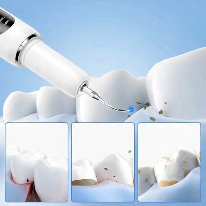 Smart Ultra-Sonic Teeth Cleaner